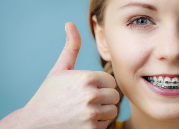 из чего складывается цена брекетов из чего складывается цена брекетов